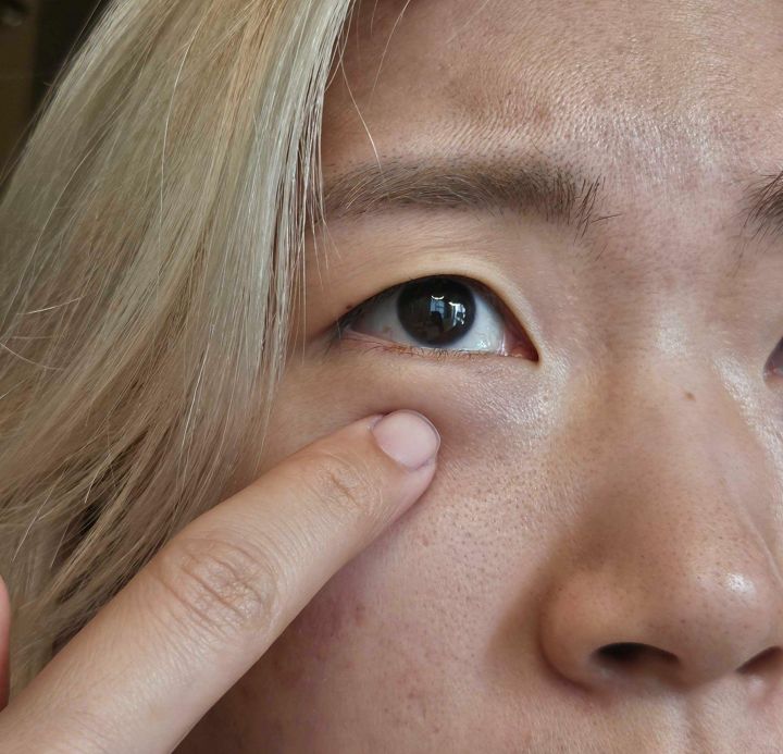 Close-up of the under-eye area before applying